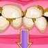Bad Teeth Makeover